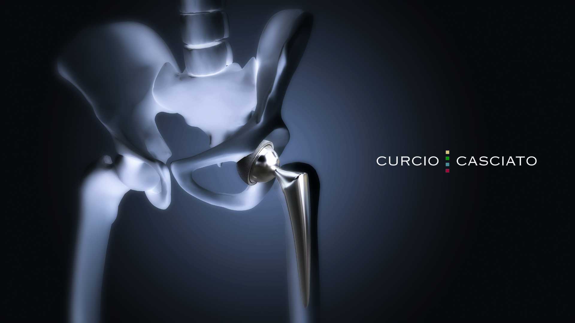 Chicago bone fracture lawyer